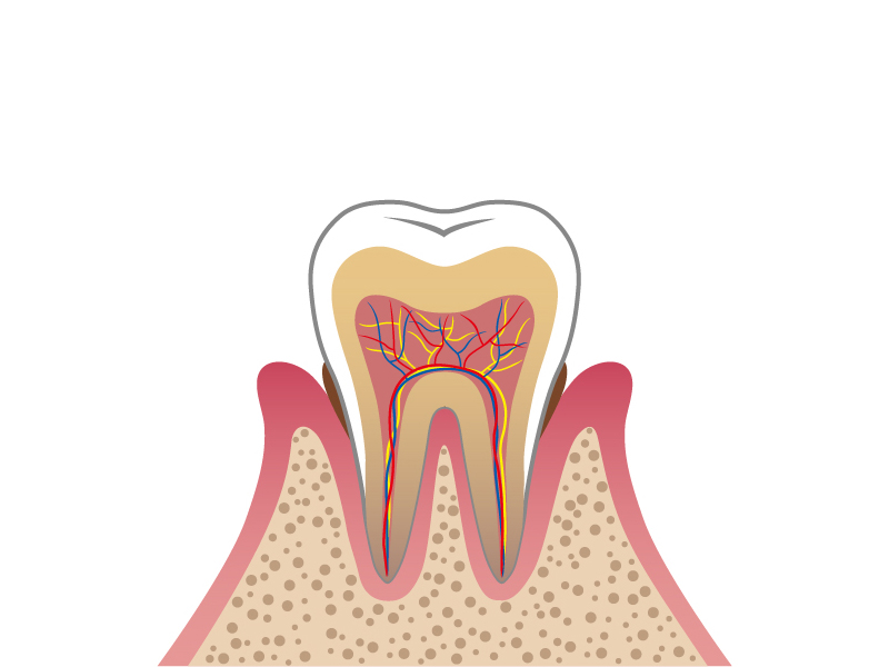 【中期】軽度歯周炎
