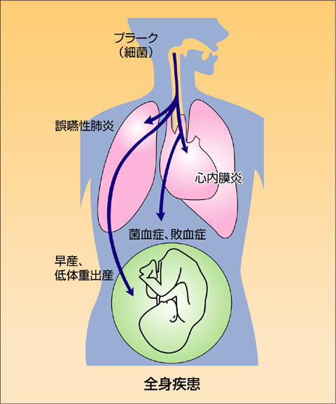 歯周病の恐怖