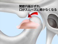 顎関節のしくみ